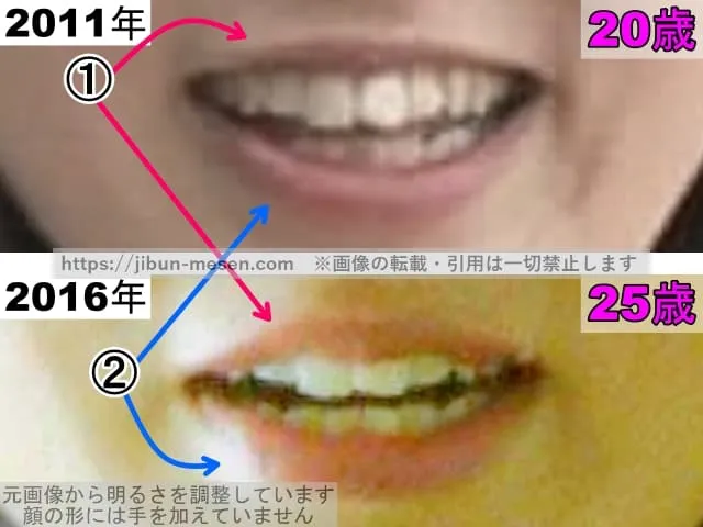朝倉あきの唇の整形検証2011年〜2016年（拡大）