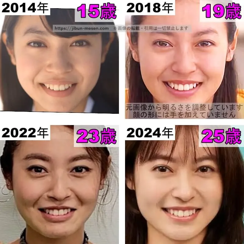 田辺桃子の目の整形検証2014年〜2024年