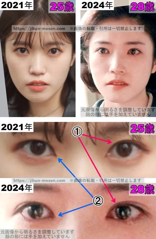 美山加恋の目の整形検証2021年〜2024年
