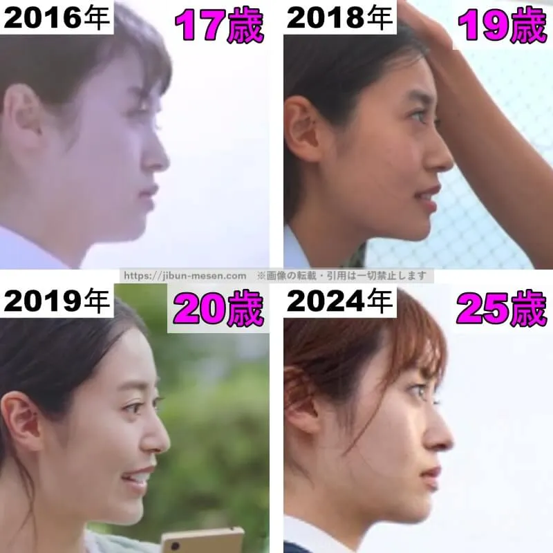 田辺桃子の鼻の整形検証2016年〜2024年（横顔）