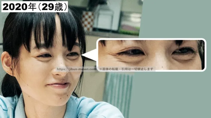 朝倉あきの涙袋