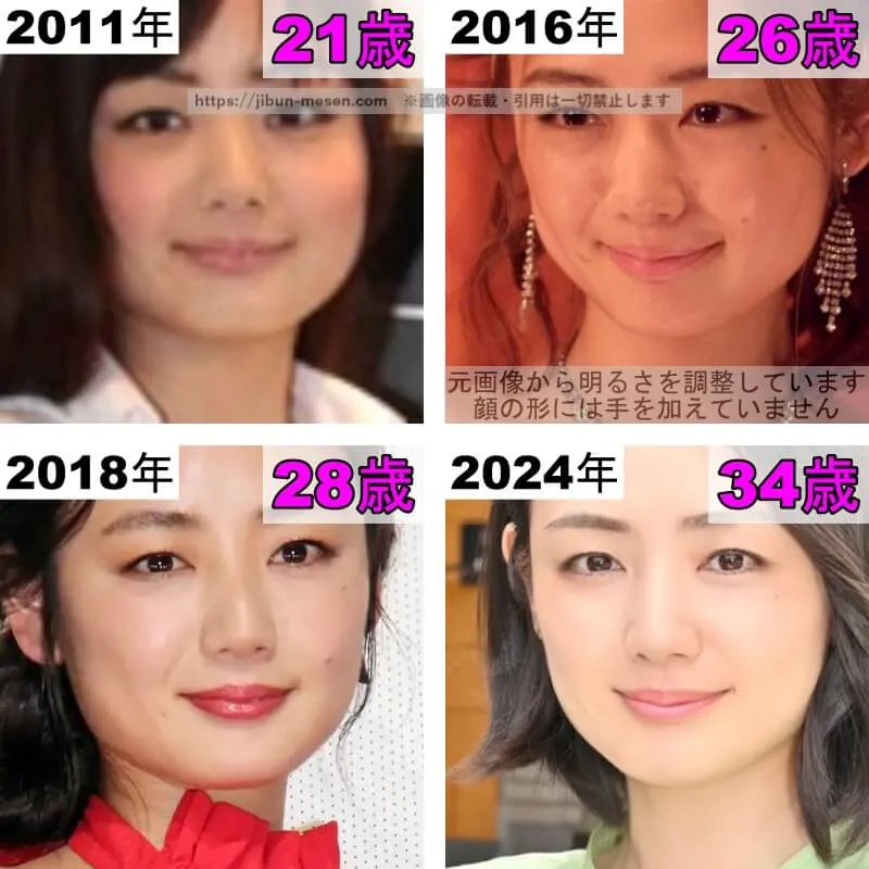 片山萌美の唇の整形検証2011年〜2024年