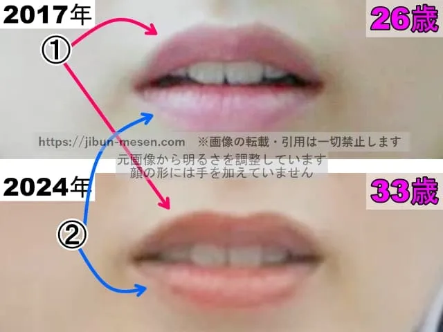 朝倉あきの唇の整形検証2017年〜2024年（拡大）