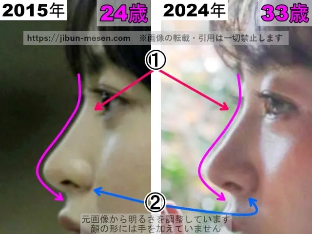 朝倉あきの鼻の整形検証2015年〜2024年（横顔・拡大）