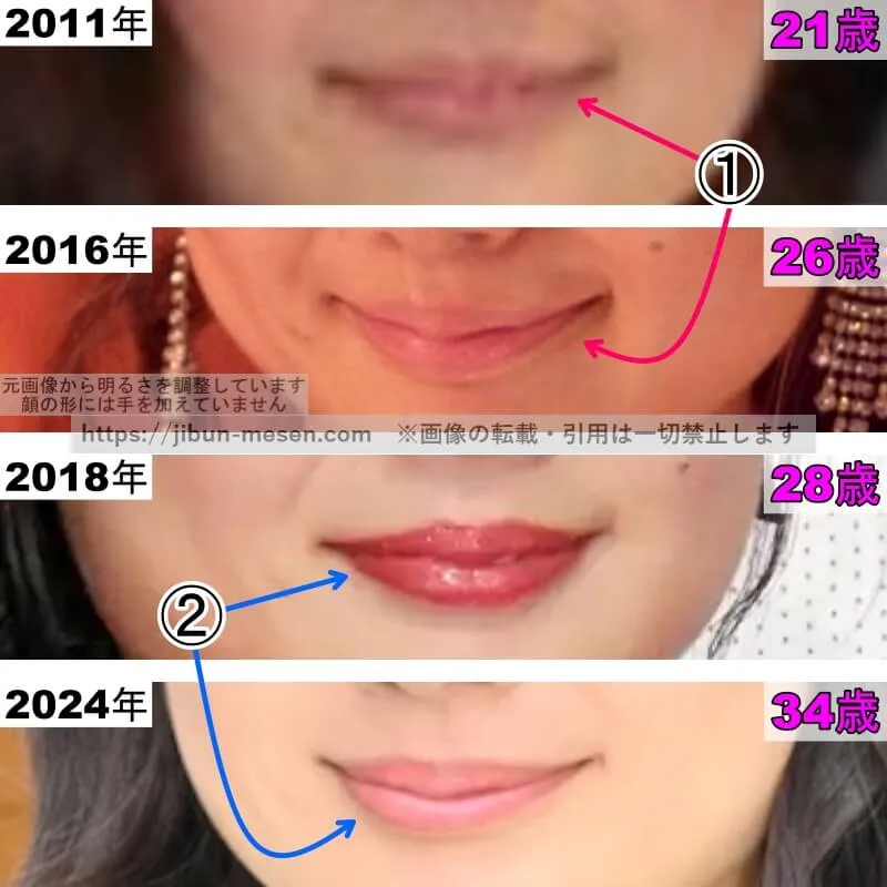 片山萌美の唇の整形検証2011年〜2024年（拡大）
