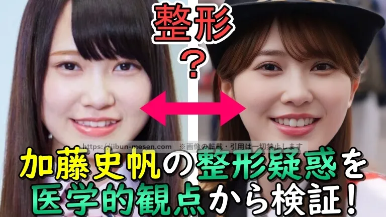 加藤志保の整形疑惑を医学的観点から検証！