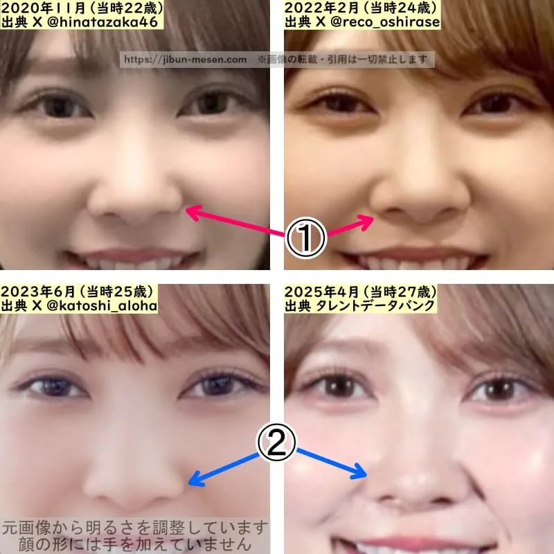加藤史帆の鼻の整形検証2020年～2025年（拡大）