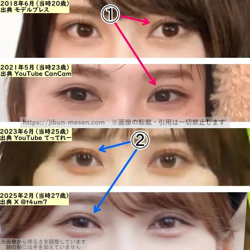 加藤史帆の目の整形検証2018年～2025年（拡大）