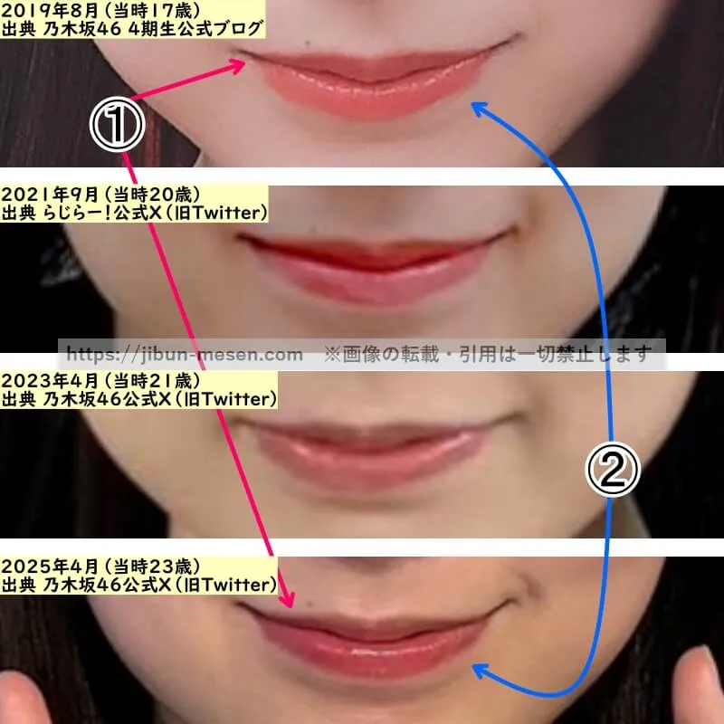 賀喜遥香の唇の整形検証2019年〜2025年（拡大）