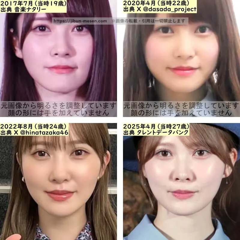 加藤史帆の唇の整形検証2017年～2025年