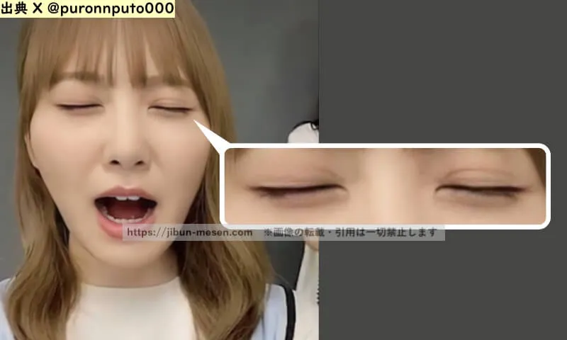 加藤史帆のアイプチの痕跡（出典 X）