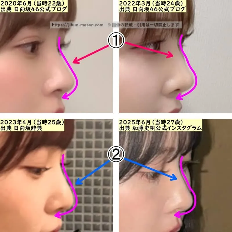 加藤史帆の鼻の整形検証2020年～2025年（横顔・拡大）