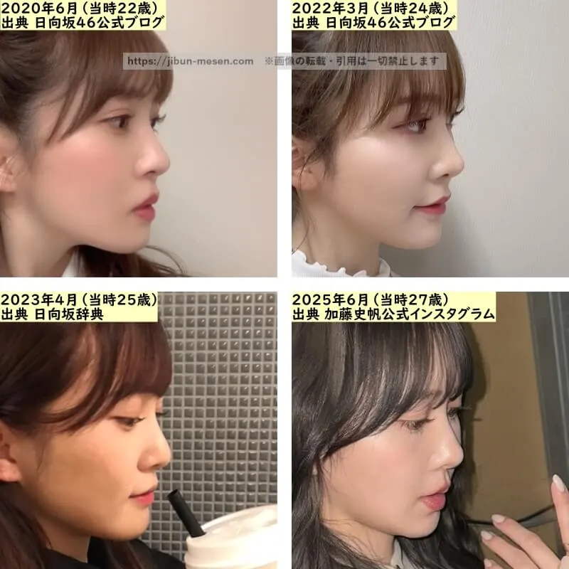 加藤史帆の鼻の整形検証2020年～2025年（横顔）