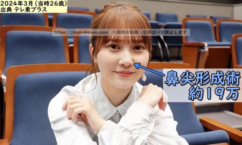 加藤史帆が整形した箇所とその費用(出典:テレ東プラス)