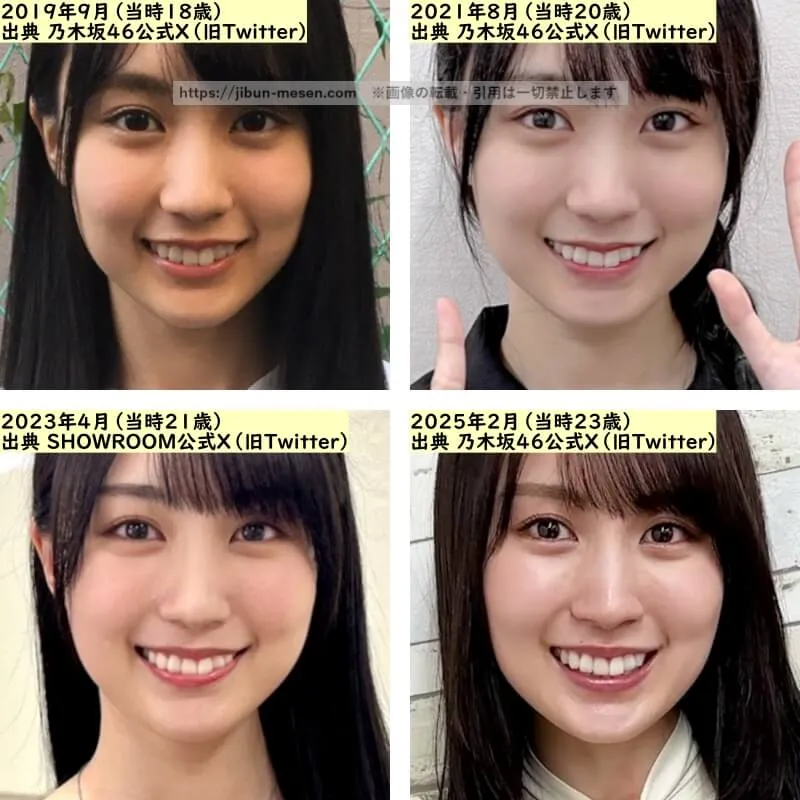 賀喜遥香の鼻の整形検証2019年〜2025年