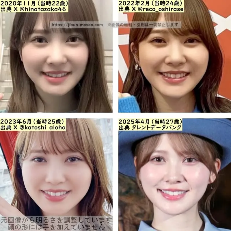 加藤史帆の鼻の整形検証2020年～2025年