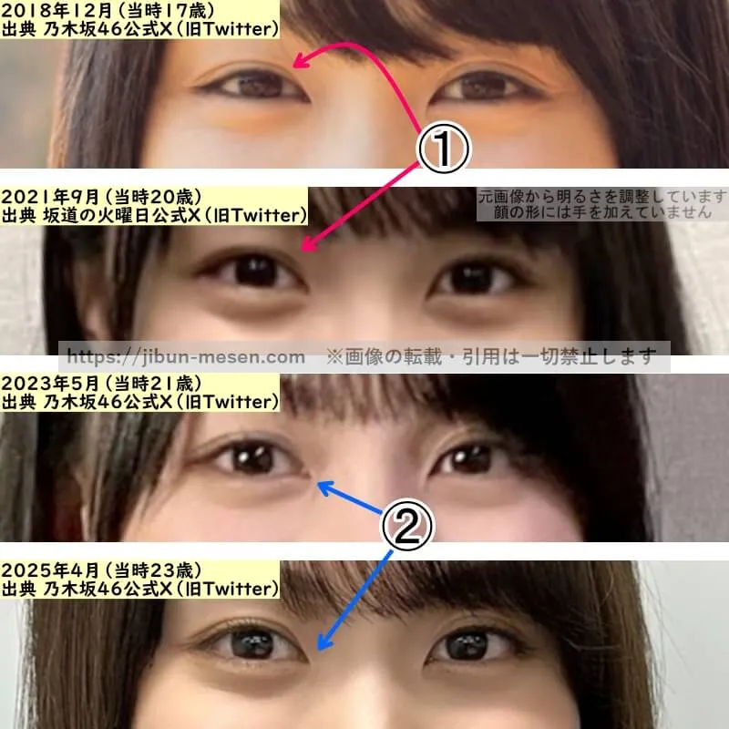 賀喜遥香の目の整形検証2018年〜2025年(拡大)