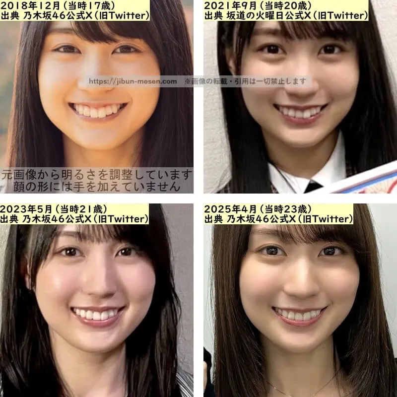 賀喜遥香の目の整形検証2018年〜2025年