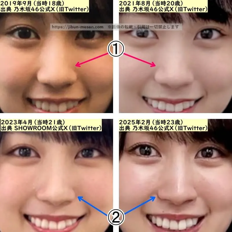 賀喜遥香の鼻の整形検証2019年〜2025年(拡大)