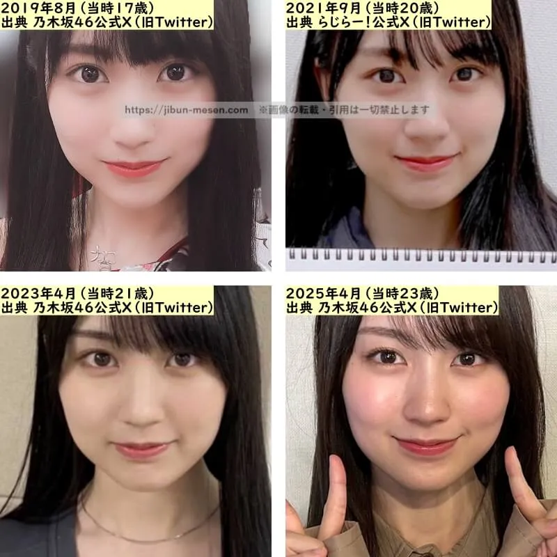 賀喜遥香の唇の整形検証2019年〜2025年