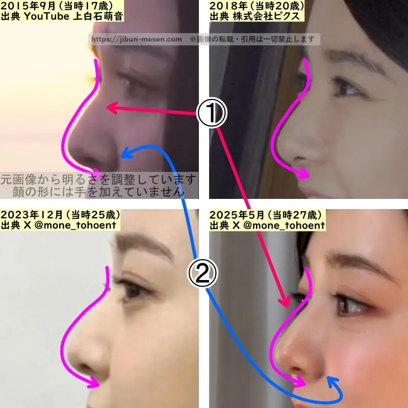 上白石萌音の鼻の整形検証2015年~2025年(横顔・拡大)