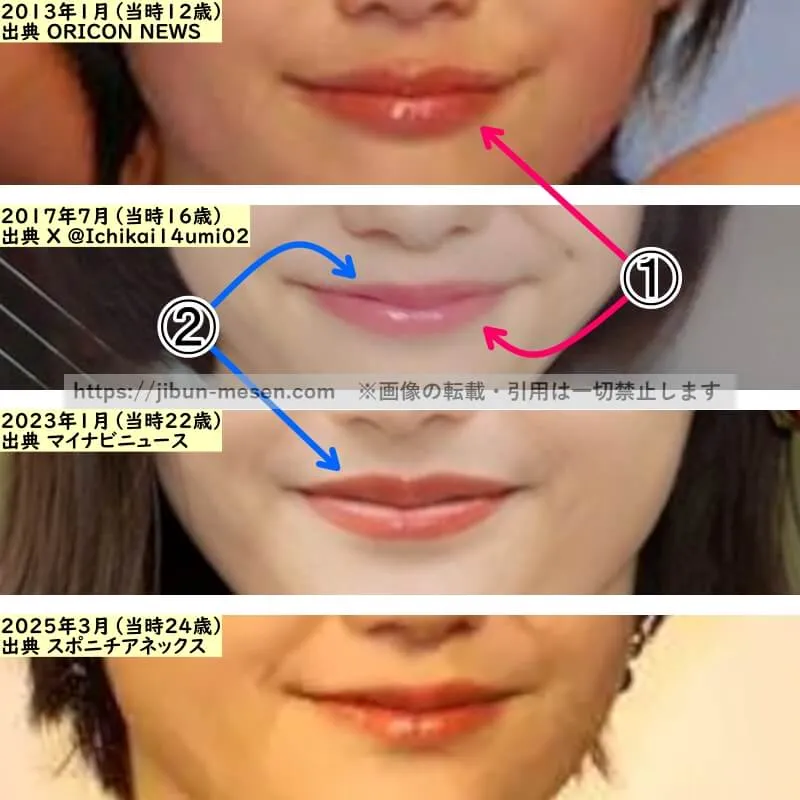 尾碕真花の唇の整形検証2013年～2025年（拡大）