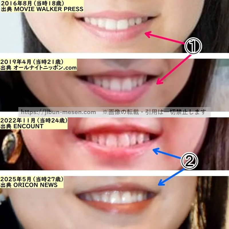 上白石萌音の唇の整形検証2016年~2025年(拡大)