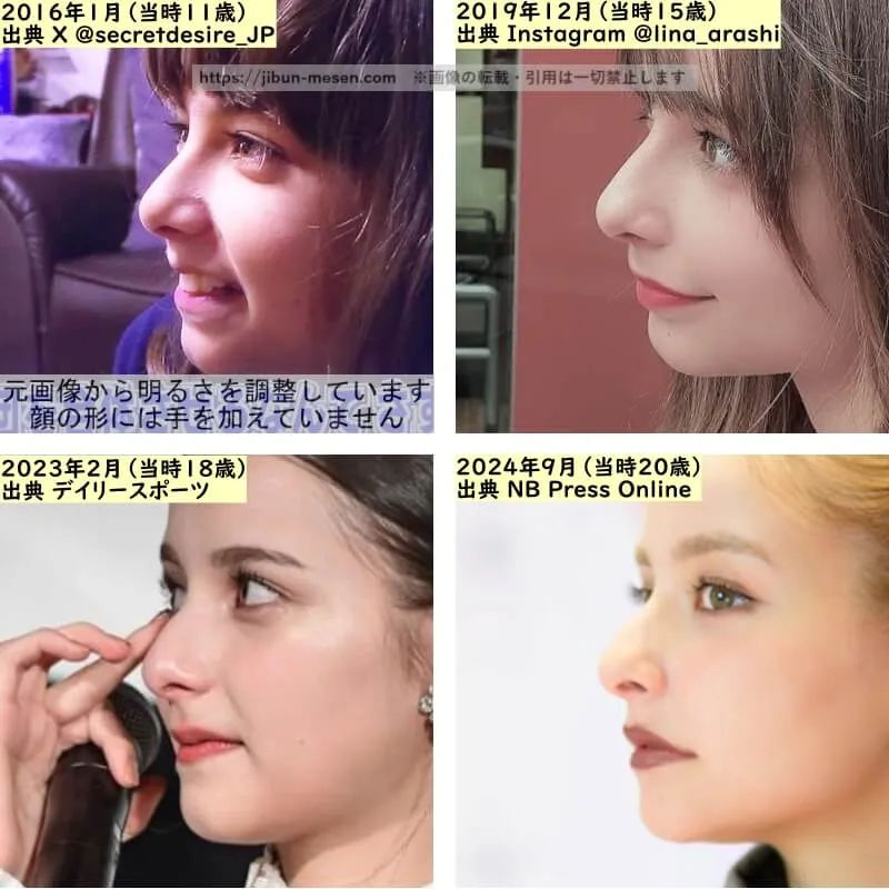 嵐莉菜の鼻の整形検証2016年～2024年（横顔）