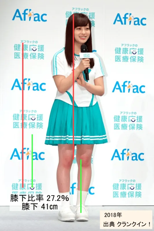 「アフラックの健康応援医療保険」商品発表会に登壇した橋本環奈（出典：クランクイン！）