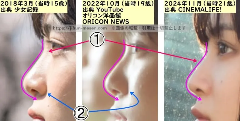 吉田美月喜の鼻の整形検証2018年～2024年（横顔・拡大）