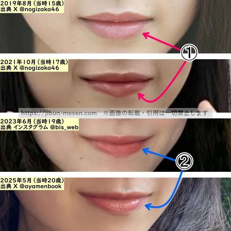 筒井あやめの唇の整形検証2019年〜2025年（拡大）