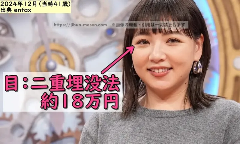 野呂佳代が整形した箇所とその費用(出典:entax)