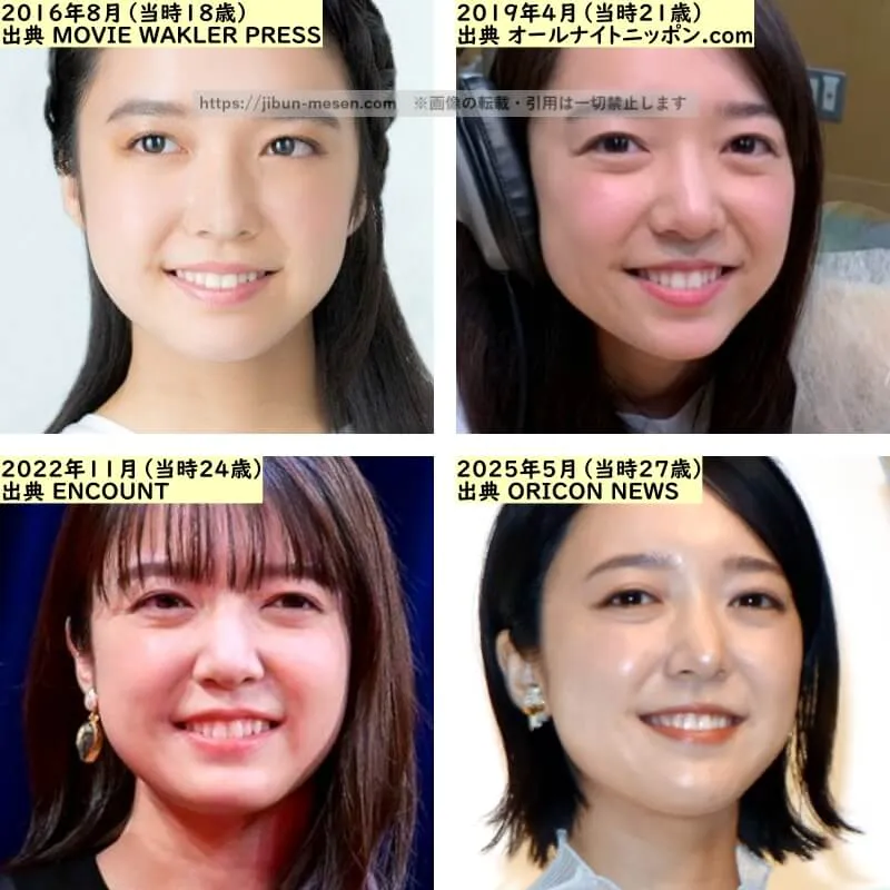 上白石萌音の唇の整形検証2016年~2025年