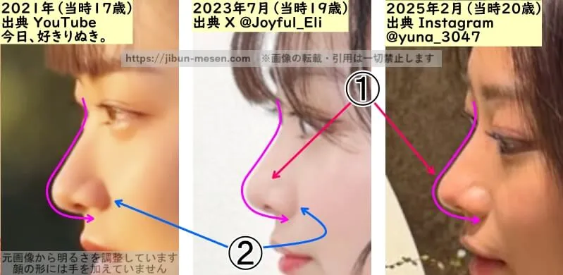 水戸由菜の鼻の整形検証2021年~2025年(横顔・拡大)