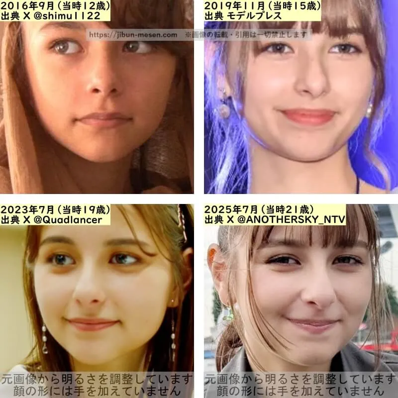 嵐莉菜の唇の整形検証2016年～2025年