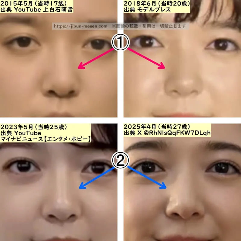 上白石萌音の鼻の整形検証2015年~2025年(拡大)