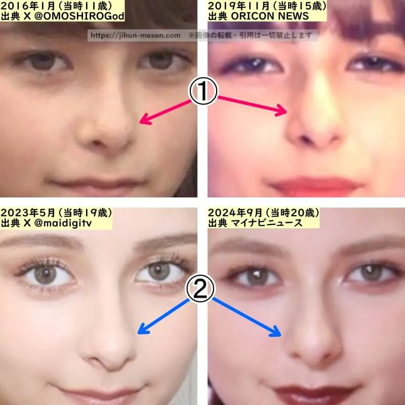 嵐莉菜の鼻の整形検証2016年～2024年（拡大）