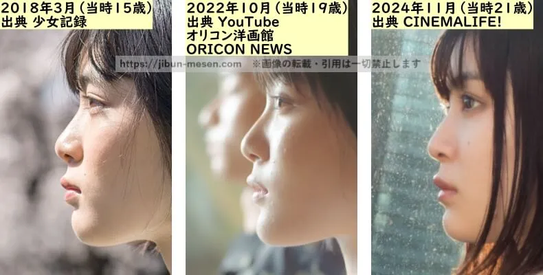 吉田美月喜の鼻の整形検証2018年～2024年（横顔）