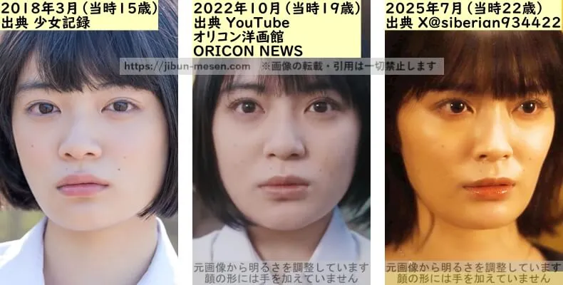 吉田美月喜の唇の整形検証2018年～2025年