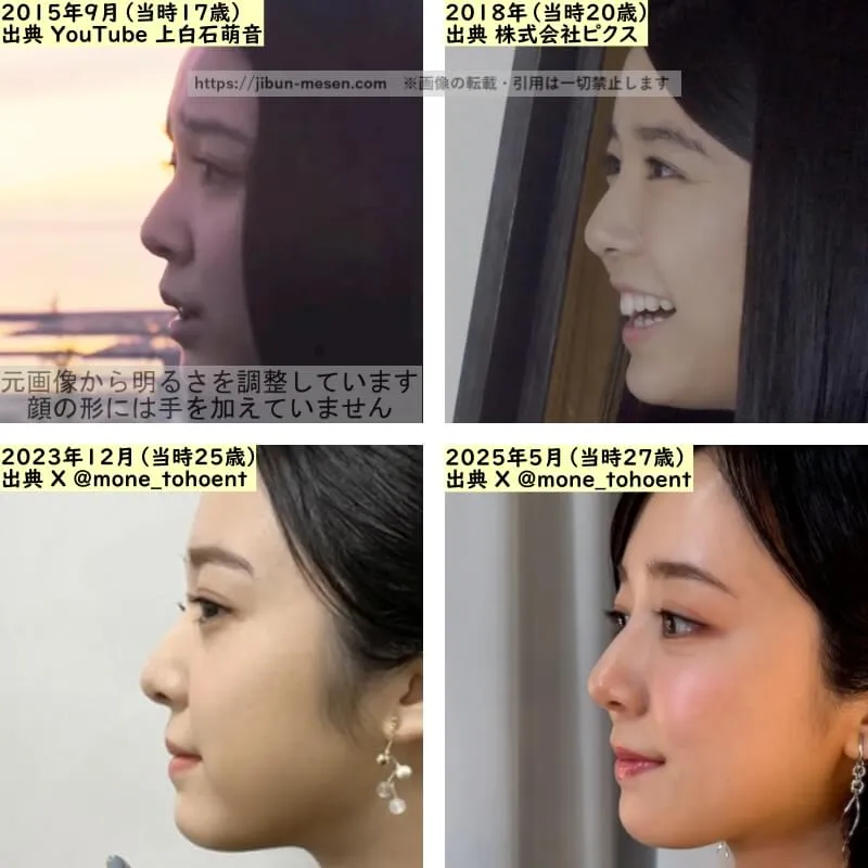 上白石萌音の鼻の整形検証2015年~2025年(横顔)
