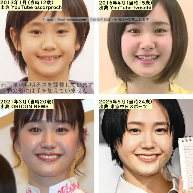 尾碕真花の目の整形検証2013年～2025年