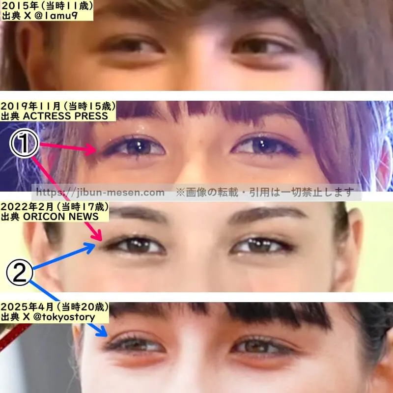 嵐莉菜の目の整形検証2016年~2025年(拡大)