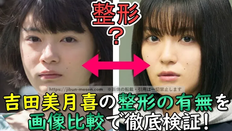 吉田美月喜の顔が変わった？整形疑惑？デビュー当時から2025年現在までの顔写真で比較・検証してみた！