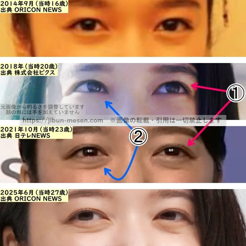 上白石萌音の目の整形検証2014年～2025年（拡大）