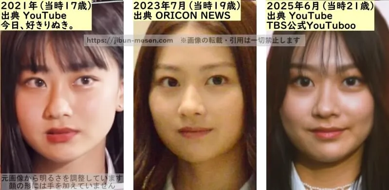 水戸由菜の鼻の整形検証2021年~2025年