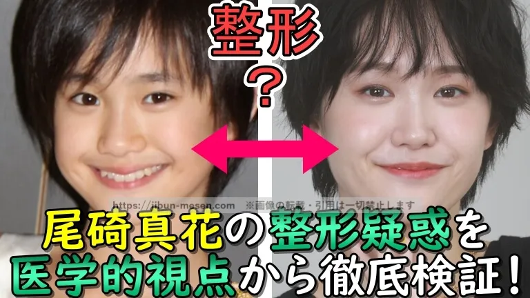 整形？尾碕真花の整形疑惑を医学的視点から徹底検証！