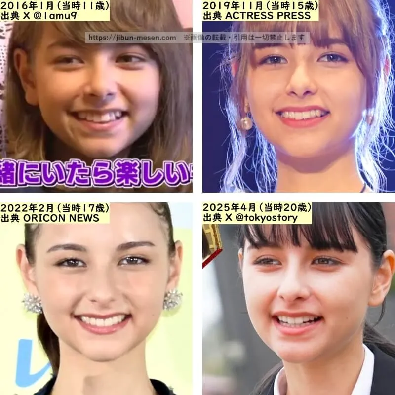 嵐莉菜の目の整形検証2016年~2025年