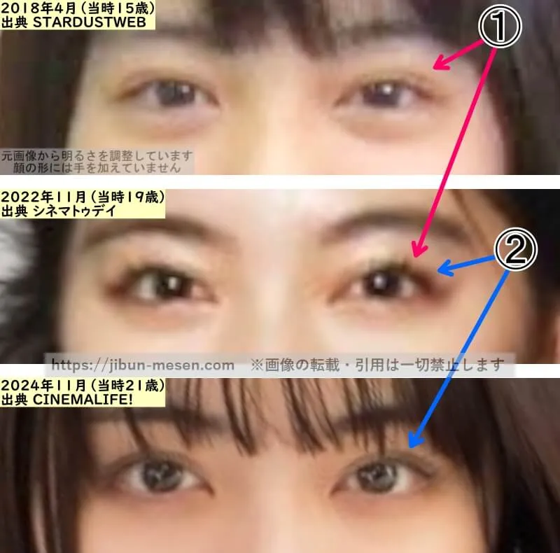 吉田美月喜の目の整形検証2018年～2024年（拡大）