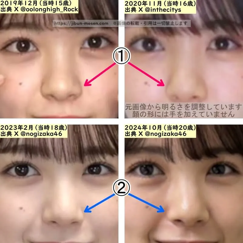 筒井あやめの鼻の整形検証2019年〜2024年（拡大）