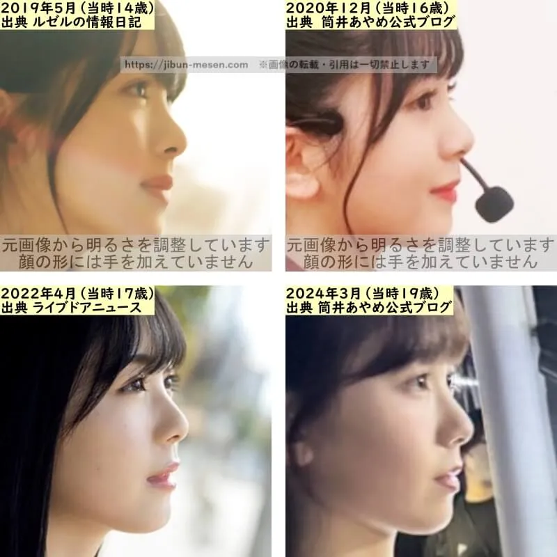 筒井あやめの鼻の整形検証2019年〜2024年（横顔）